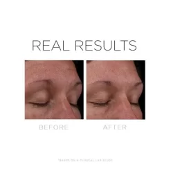 Cosmedix Serum 16 -Skin Care Store CosmedixSerum16beforeandafter