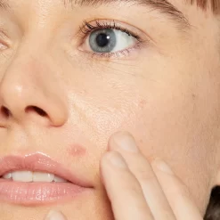 Dermalogica Deep Breakout Liquid Patch -Skin Care Store DermalogicaDeepBreakoutLiquidPatch