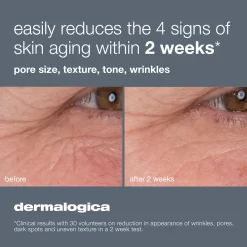 Dermalogica Dynamic Skin Retinol Serum -Skin Care Store Dynamic Skin Retinol Serum Dermalogica before And after