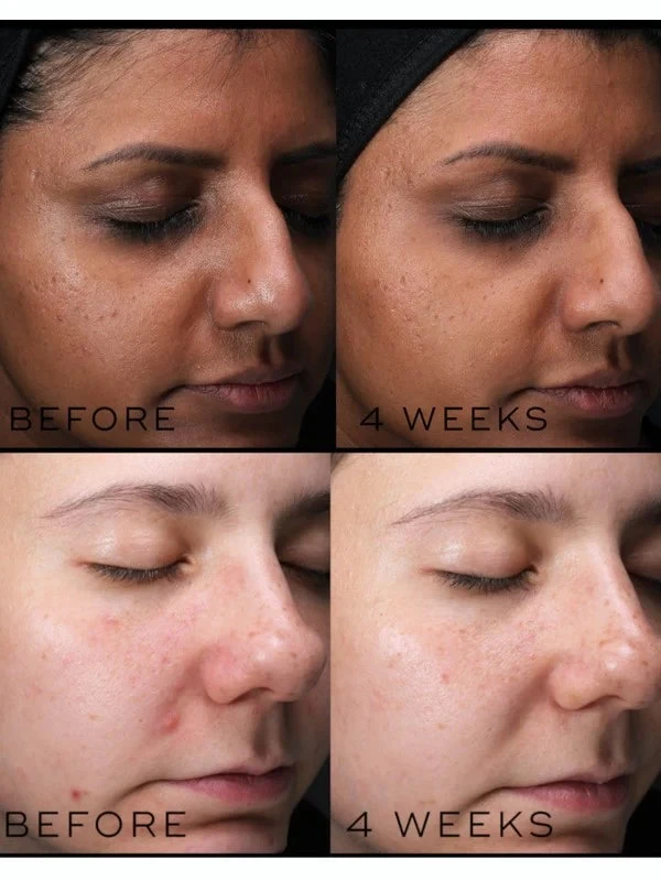 Medik8 Balance Moisturiser With Glycolic Acid Activator 7 Medik8 Balance Moisturiser With Glycolic Acid Activator - Image 7