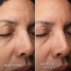 Medik8 C-Tetra Luxe 18 Medik8 C-Tetra Luxe -Skin Care Store Medik8C TetraLuxeBefore After