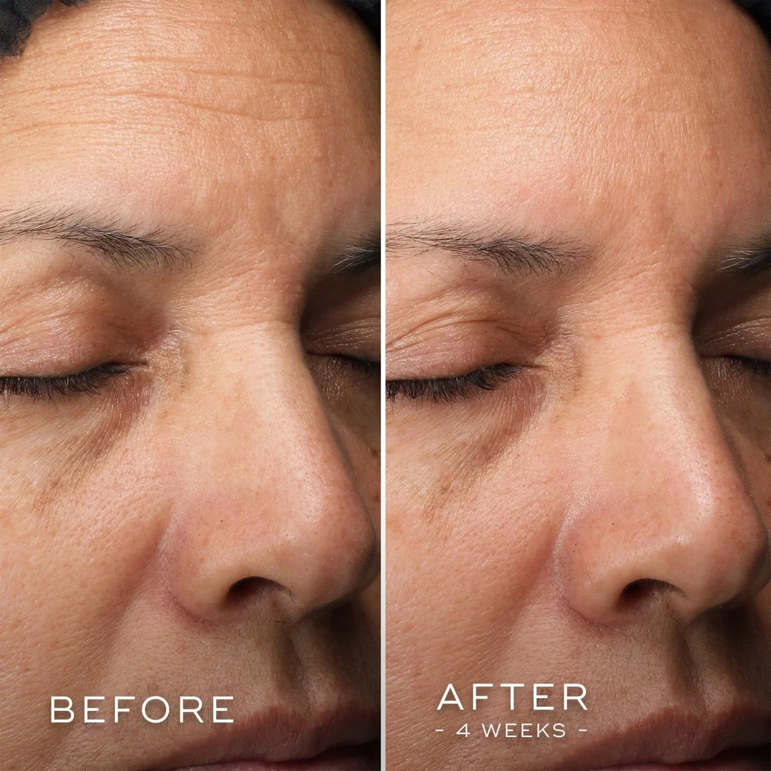 Medik8 C-Tetra Luxe 5 Medik8 C-Tetra Luxe - Image 5