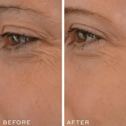 Medik8 Crystal Retinal 1 16 Medik8 Crystal Retinal 1 -Skin Care Store Medik8CrystalRetinal1beforeandafter