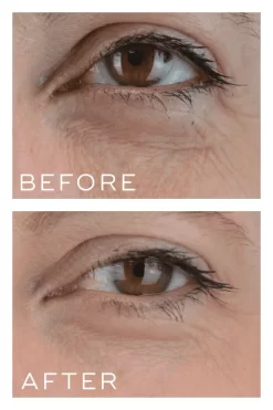 Medik8 Crystal Retinal 3 -Skin Care Store Medik8CrystalRetinal3beforeandafter
