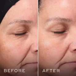 Medik8 Press & Glow -Skin Care Store Medik8Press GlowBefore After
