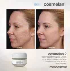 Mesoestetic Cosmelan 2 Maintenance Cream -Skin Care Store Mesoestetic Cosmelan 2 Maintenence Cream