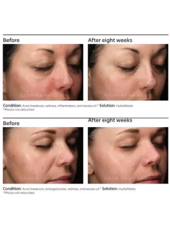 PCA Skin HydraMatte -Skin Care Store PCASkinHydraMatteOnline