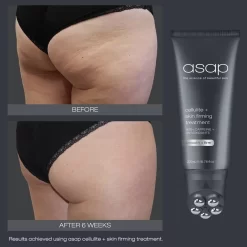 Asap Cellulite And Skin Firming Treatment -Skin Care Store asapcelluliteandskinfirmingtreatment200ml beforeandafter