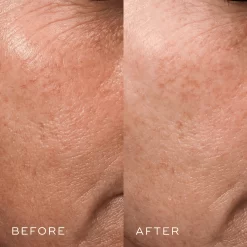 Medik8 Crystal Retinal 3 -Skin Care Store before after 2 medik8 howtoUseMedik8CrystalRetinal