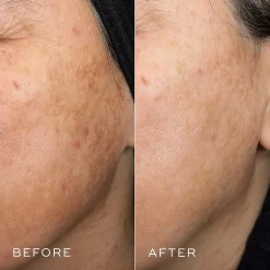 Medik8 Crystal Retinal 10 -Skin Care Store crystal 10 retinal