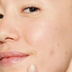 Dermalogica Deep Breakout Liquid Patch -Skin Care Store dermalogica acne treatments