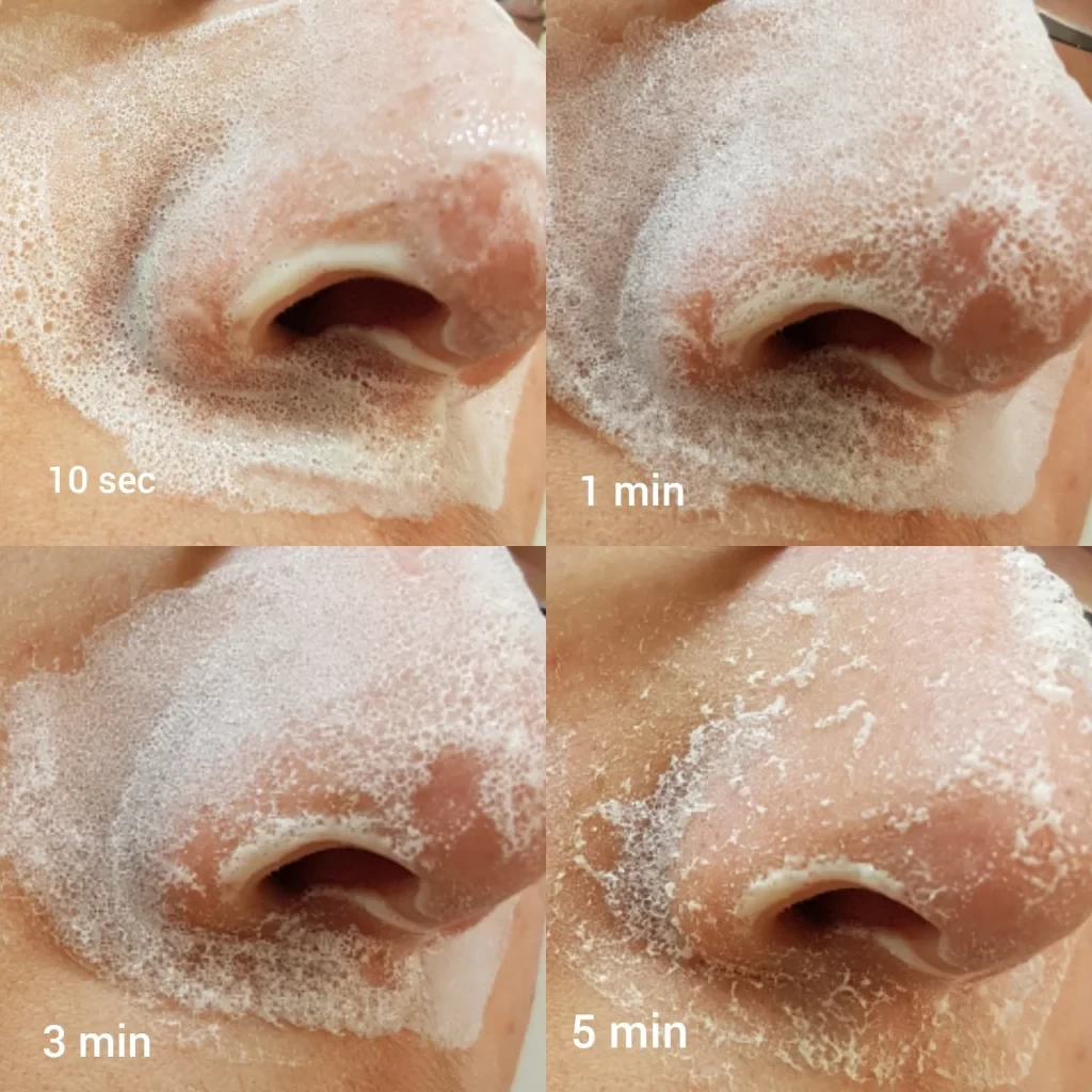 Dermalogica Blackhead Clearing Fizz Mask 17 Dermalogica Blackhead Clearing Fizz Mask - Image 17