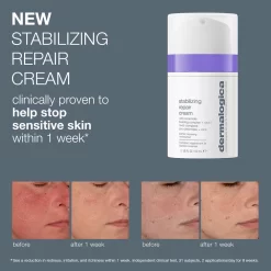 Dermalogica Stabilizing Repair Cream -Skin Care Store dermalogica stabilizing repair cream before and after