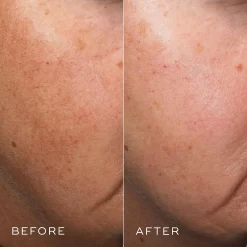 Medik8 Crystal Retinal 10 -Skin Care Store medik8 crystal 10 before after